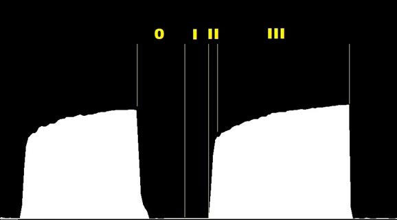 Figure 2. The positions of each phase on a capnogram.