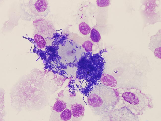 Figure 6. Extensive contamination in a sample of tracheal aspirate fluid.