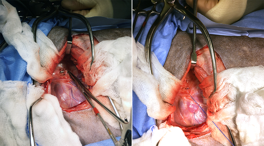 Left: the inside of Jip’s chest, showing the base of the heart and the vagus nerve held away with a suture. Right: the abnormally positioned ligament has been tied and cut to release the oesophagus, relieving the constriction.
