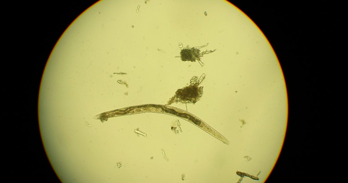 Figure 1. A free-living soil nematode.