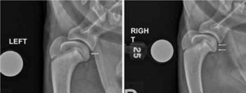 Figure 3. Diagnostic images of the right elbow of a one-year-old male German shepherd dog that presented for a two-month history of progressively worsening right thoracic limb lameness. (3a) Lateral view with typical blunting of the medial aspect of the coronoid (yellow arrow) and sclerosis of the trochlear notch (white arrows). (3b) Craniocaudal view. Note the osteophytes on the medial humeral epicondyle (green arrow) and coronoid process (blue arrow). (3c and 3d) CT scan, coronal and sagittal views of the elbow joint showing evident coronoid fragmentation (red arrow). (3e) 3D reconstruction of CT images clearly showing the fissured medial coronoid process (red arrow), as well as typical osteophytosis on the cranial aspect of the radial head (purple arrow).