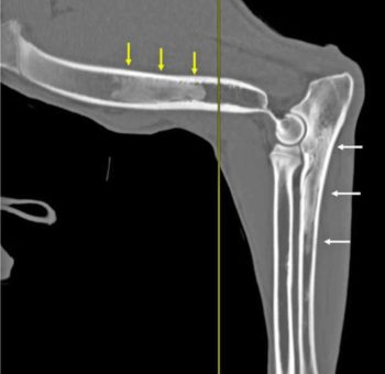 Figure 6. CT image (sagittal view) of the left antebrachium of a seven-month old intact male German shepherd dog that presented with a three-month history of waxing and waning left forelimb lameness. Note the intramedullary opacities consistent with panosteitis within the proximal ulna (white arrows) and mid-diaphysis of the humerus (yellow arrows). The elbow joint is within normal limits.