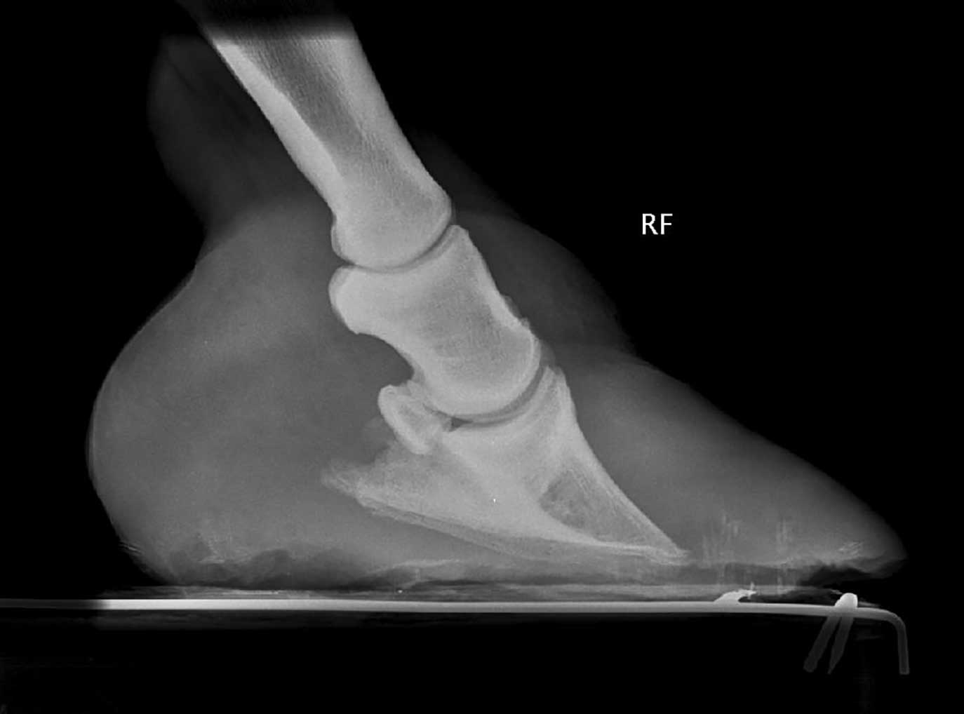 The focus of treatment for laminitis has shifted toward prevention through the management of equine metabolic syndrome.