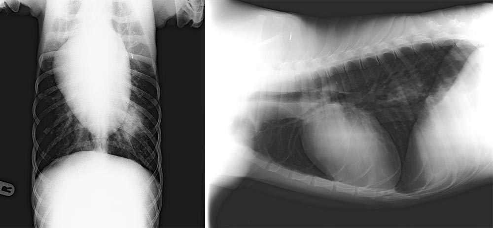 X-ray images showing the abscess.