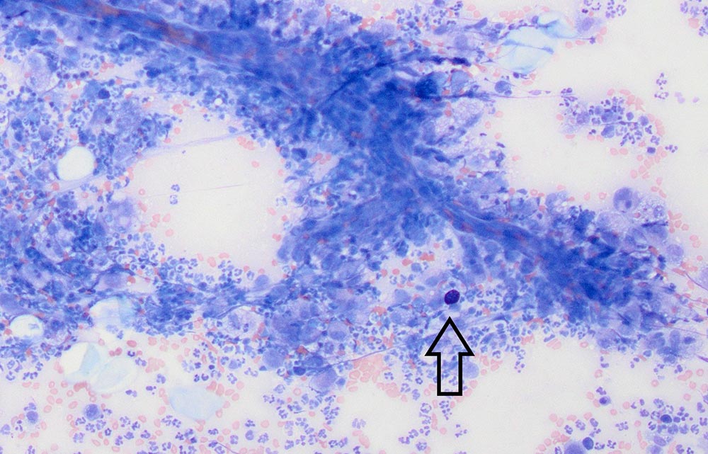 An unsubtle mast cell.