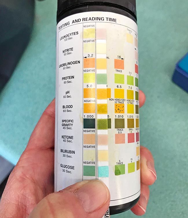 Figure 1. Dipsticks are unreliable for a number of parameters including leukocytes, nitrites, specific gravity and urobilinogen. A positive leukocyte reaction is not diagnostic for a bacterial urinary tract infection.