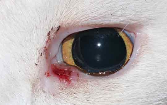 Figure 2. Proliferative medial lower eyelid squamous cell carcinoma in the right eye.
