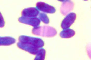 A photomicrograph of Malassezia organisms stained with Diff-Quik.