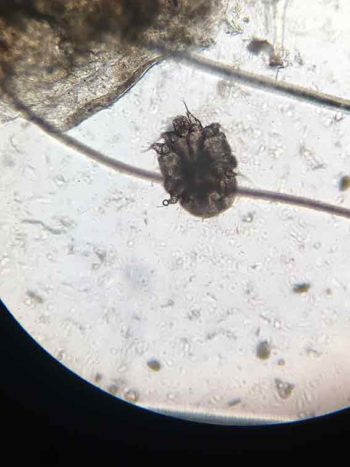 A photomicrograph of a Sarcoptes scabiei mite.