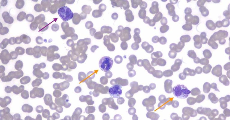 Clinical case of a dog with eosinophilia and basophilia | Vet Times