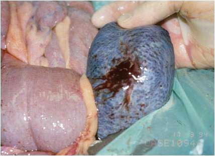 Figure 3. Blood in the sample may be due to perforation of the spleen.