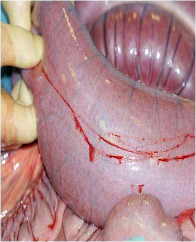 Figure 5. Superficial scratching of the intestinal wall, but if deeper, this could be a laceration. The horse moved abruptly during sampling. Image: Dylan Gorvy