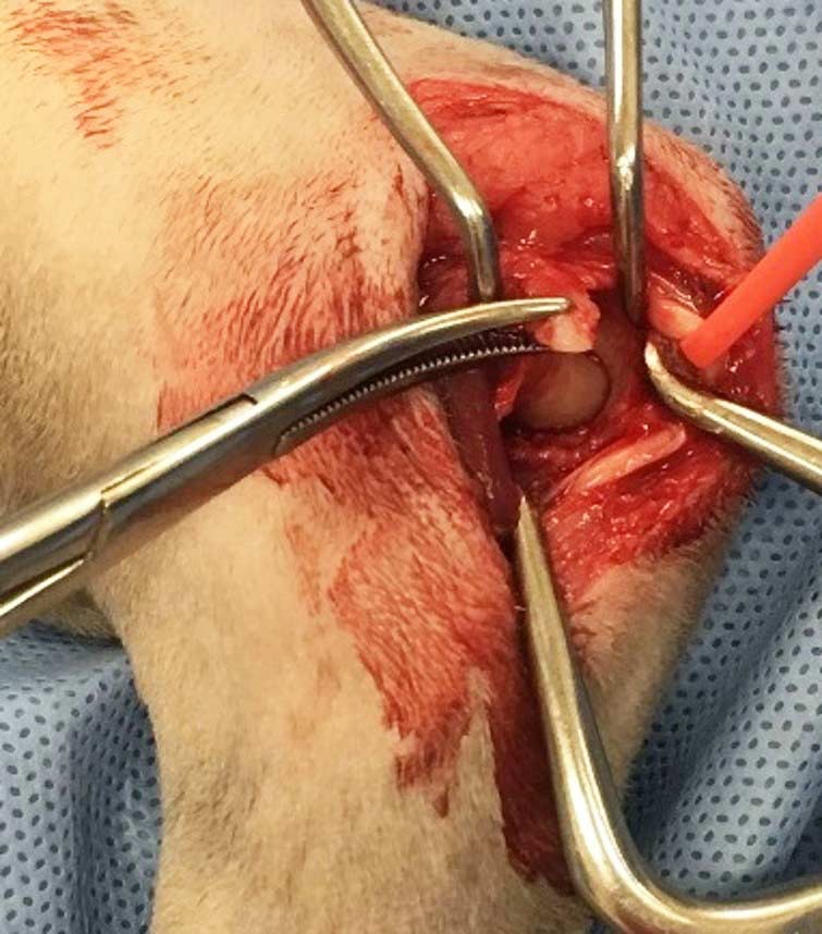 Figure 3. Intraoperative photograph of a cat undergoing surgical treatment for medial humeral epicondylitis. The humeral head of the flexor carpi ulnaris has been identified. The mineralised material within the origin of the muscle has been isolated and is ready to be excised.