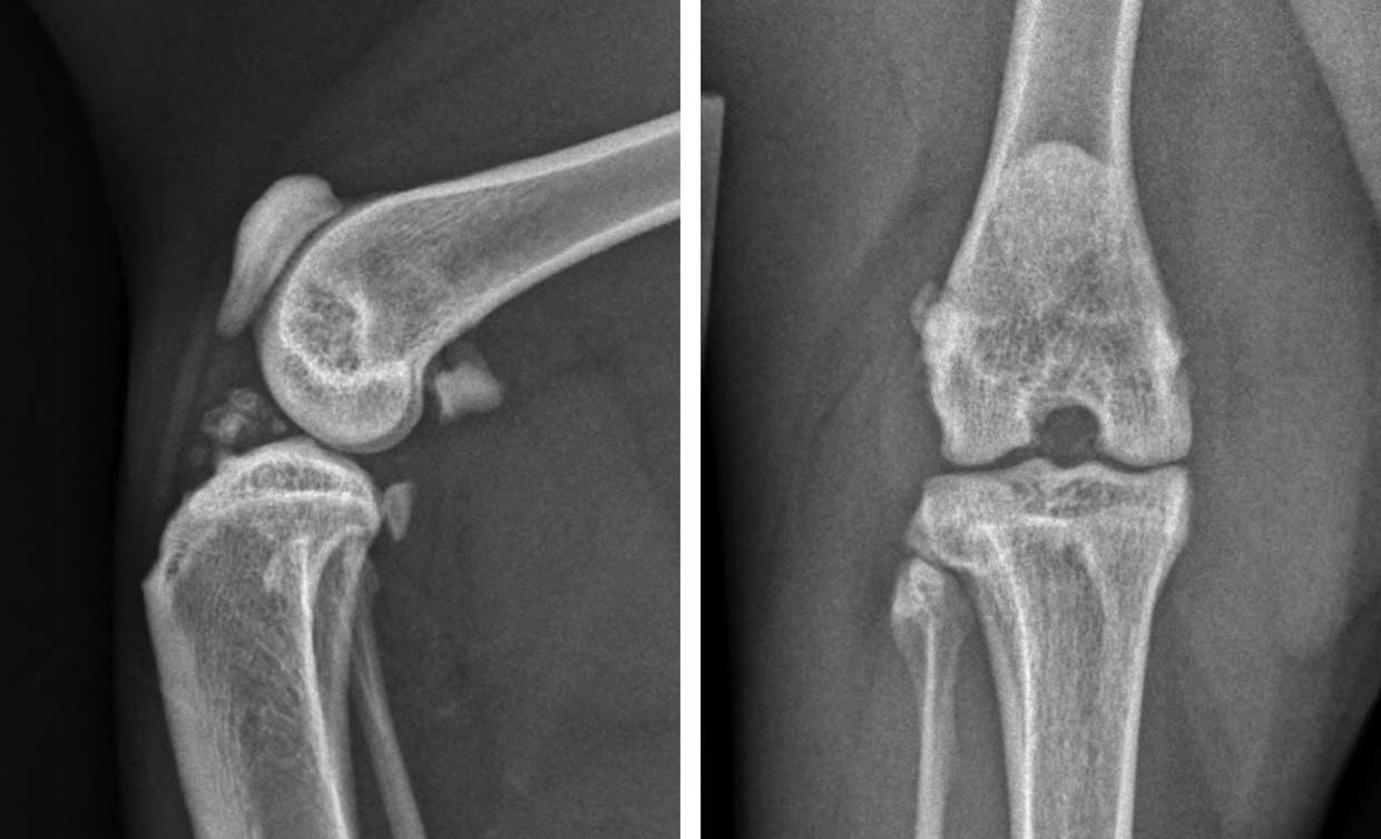 Figure 6. Mediolateral and craniocaudal radiographs of the left stifle of a cat with, presumed degenerative, cranial cruciate ligament failure. Note the effacement of the infrapatellar fat pad, mild periarticular osteophytosis particularly evident at the cranial aspect of the tibial plateau and the intra-articular mineralisation cranially.