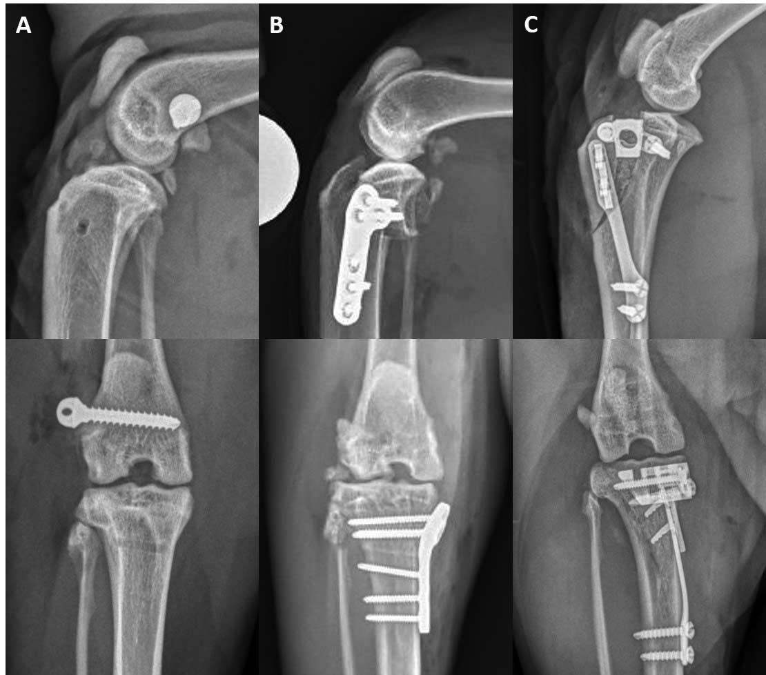 Figure 8. Mediolateral and craniocaudal radiographs taken immediately postoperatively of three cats, all diagnosed with cranial cruciate ligament failure with no traumatic inciting cause. Procedures performed were: (8a) – lateral extracapsular suture using a 2.7mm suture anchor in the lateral femoral condyle, (8b) – tibial plateau-levelling osteotomy using a 2.4mm plate, and (8c) – tibial tuberosity advancement using a 2-tyne plate and a 6mm cage.