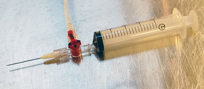 Figure 4. Use of a 20ml syringe, and three-way tap and a 19-gauge needle to irrigate a wound. This apparatus will generate irrigation pressure of around 7psi to 8psi.