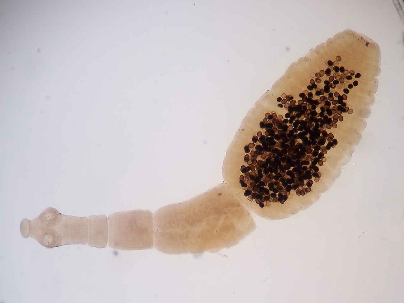 Echinococcus granulosus. Image: Leoncastro / Wikimedia Commons