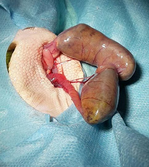 Figure 4. The intestines containing the obstruction were exteriorised and placed on sterile saline-soaked swabs.
