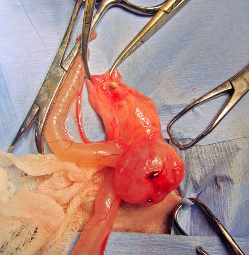 Figure 11. Ureterotomy can be attempted for removal of stones localised within the ureter, but the significant complications following this procedure should be taken into consideration.