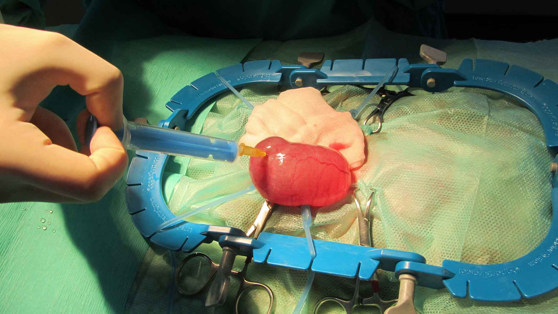 Figure 7. Ovariohysterectomy is considered the treatment of choice and it is usually curative in cases of ovarian cysts. Cyst aspiration during the surgical procedure, may help with removal, especially when cysts are very large.
