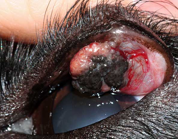 Figures 2 and 3. Meibomian gland epithelioma. Eversion of the eyelid reveals the extent of the tumour.