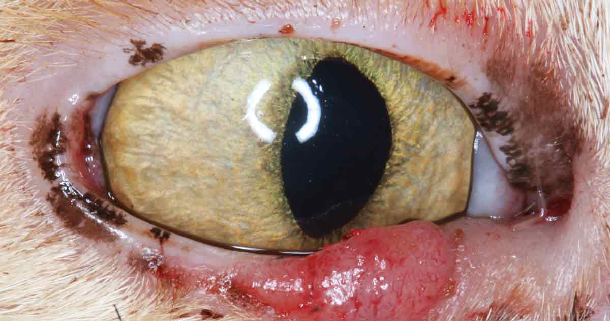 Figure 1. Erosive medial canthal and medial upper eyelid squamous cell carcinoma in the right eye.
