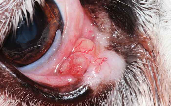 Figure 9. Clinical presentation of the meibomian gland adenoma involving the medial lower eyelid; lower eyelid punctum was visualised by flushing the upper eyelid punctum and it was repositioned medially.