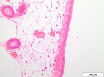 Figure 2. Histology of an endometrial biopsy, Kenney Grade I (no significant abnormality). Magnification ×400.