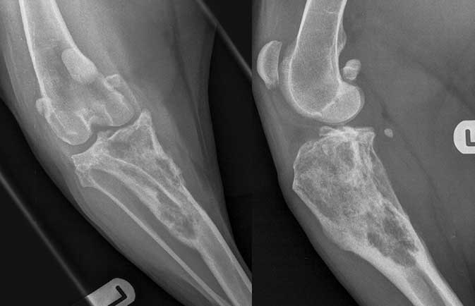 Figure 3. Stifle x-rays showed increased lucency in the proximal tibia, with cortical thinning, loss of normal trabecular pattern in the metaphysis and also Codman’s triangle (especially present on the caudocranial view). A pathological fracture of the tibial plateau is also suspected.