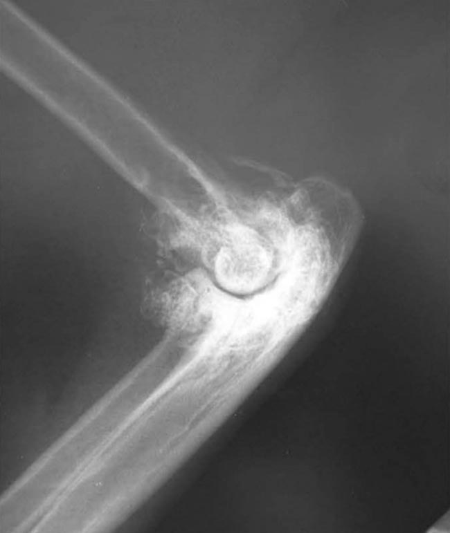 Figure 1. Severe bone remodelling in the elbow of a cat with arthritis.