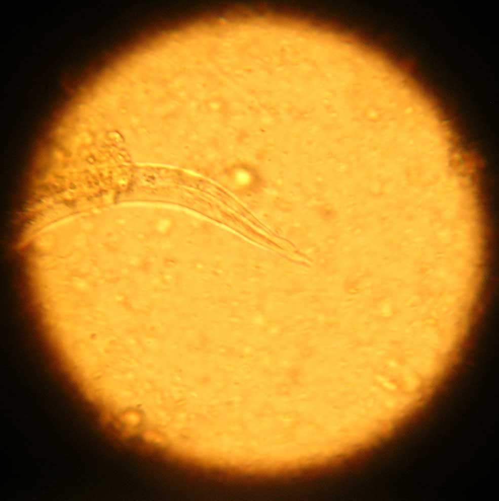 Figure 1. Tail of Angiostrongylus vasorum larvae. Image: Pedro Serra, NWL