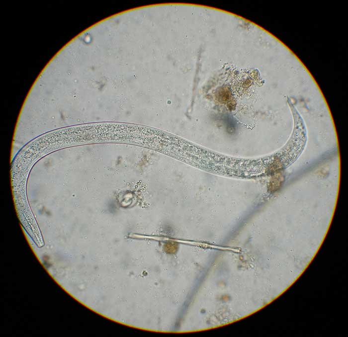 Figure 3. Crenosoma vulpis first-stage larvae larva.