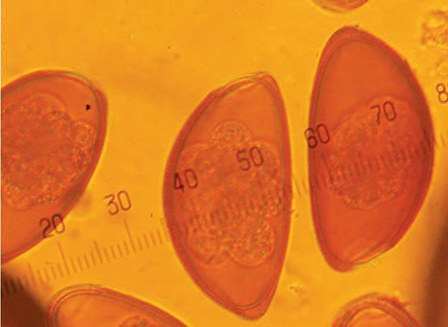 Figure 4. Oxyurid (pinworm) ova from a leopard gecko.