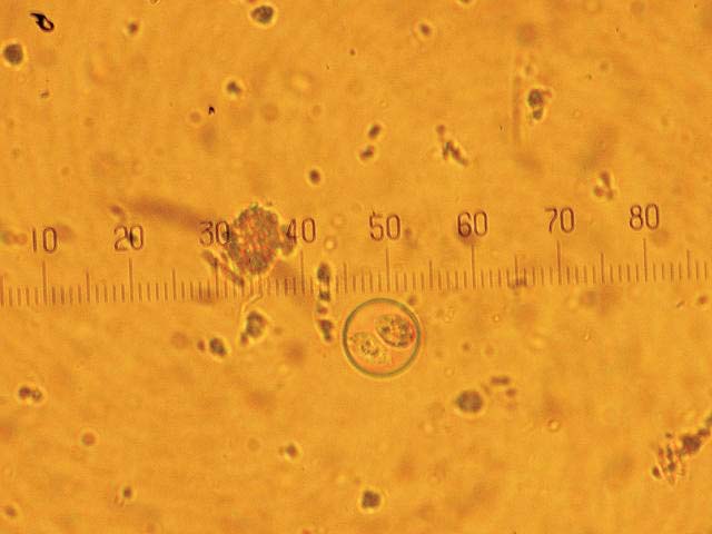 Figure 5. Coccidia from a bearded dragon.
