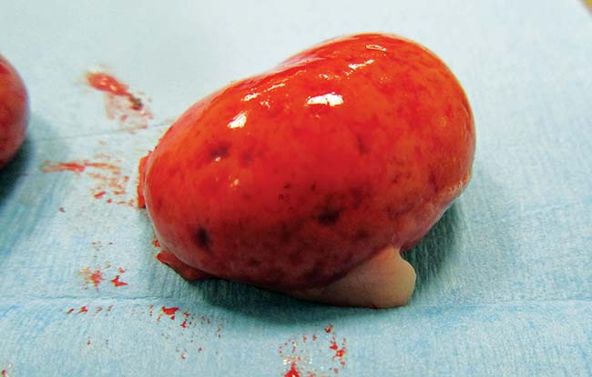Figure 3. Multiple irregular, dark red, depressed, subcapsular foci on the surface ofthe renal cortices are often visible on postmortem examination and are considered indicative of encephalitozoonosis.