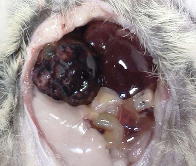 Figure 2. Intraoperative view of liver mass confirmed on histology as hepatic carcinoma.