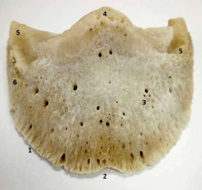 Figure 1a. Dry specimen of distal phalanx: 1 = solar margin; 2 = crena; 3 = parietal foramen; 4 = extensor process; 5 = palmar processes.