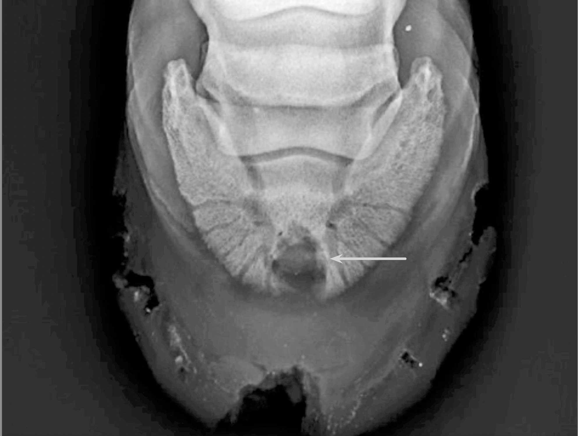 Figure 2. Dorsoproximal palmar/plantarodistal oblique radiograph showing area of focal demineralisation (arrow) in patient with septic pedal osteitis due to chronic subsolar abscessation. Image: University of Liverpool