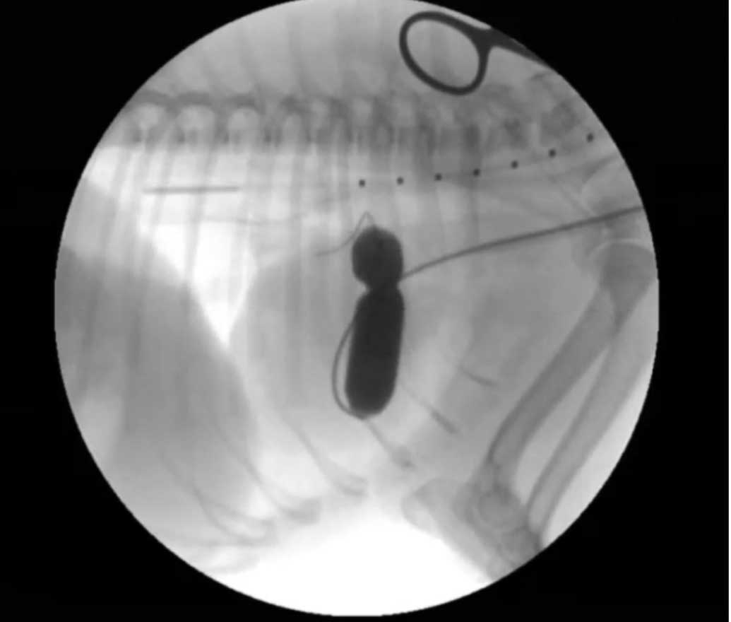 Figure 6. Balloon valvuloplasty in a dog with pulmonic stenosis.