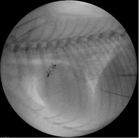 Figure 8. An Amplatz vascular plug placed in a patent ductus arteriosus in a 3.3kg dog.