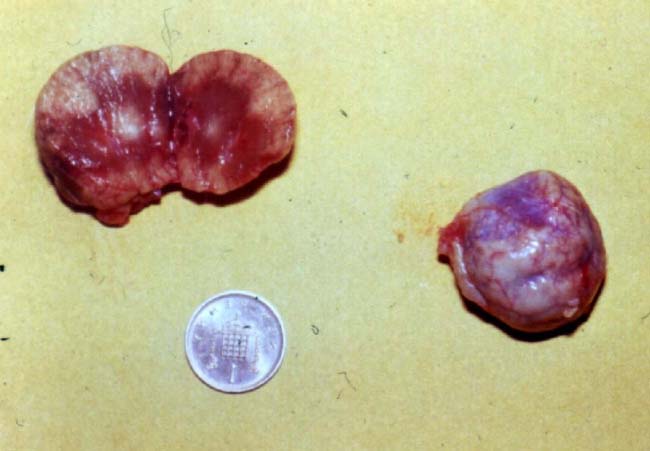 Figure 3. Small, fibrosed kidneys from a cat. It is remarkable that this cat survived with so little normal renal tissue left. This demonstrates the significance of renal reserve and the need to delay progressive damage if possible. 