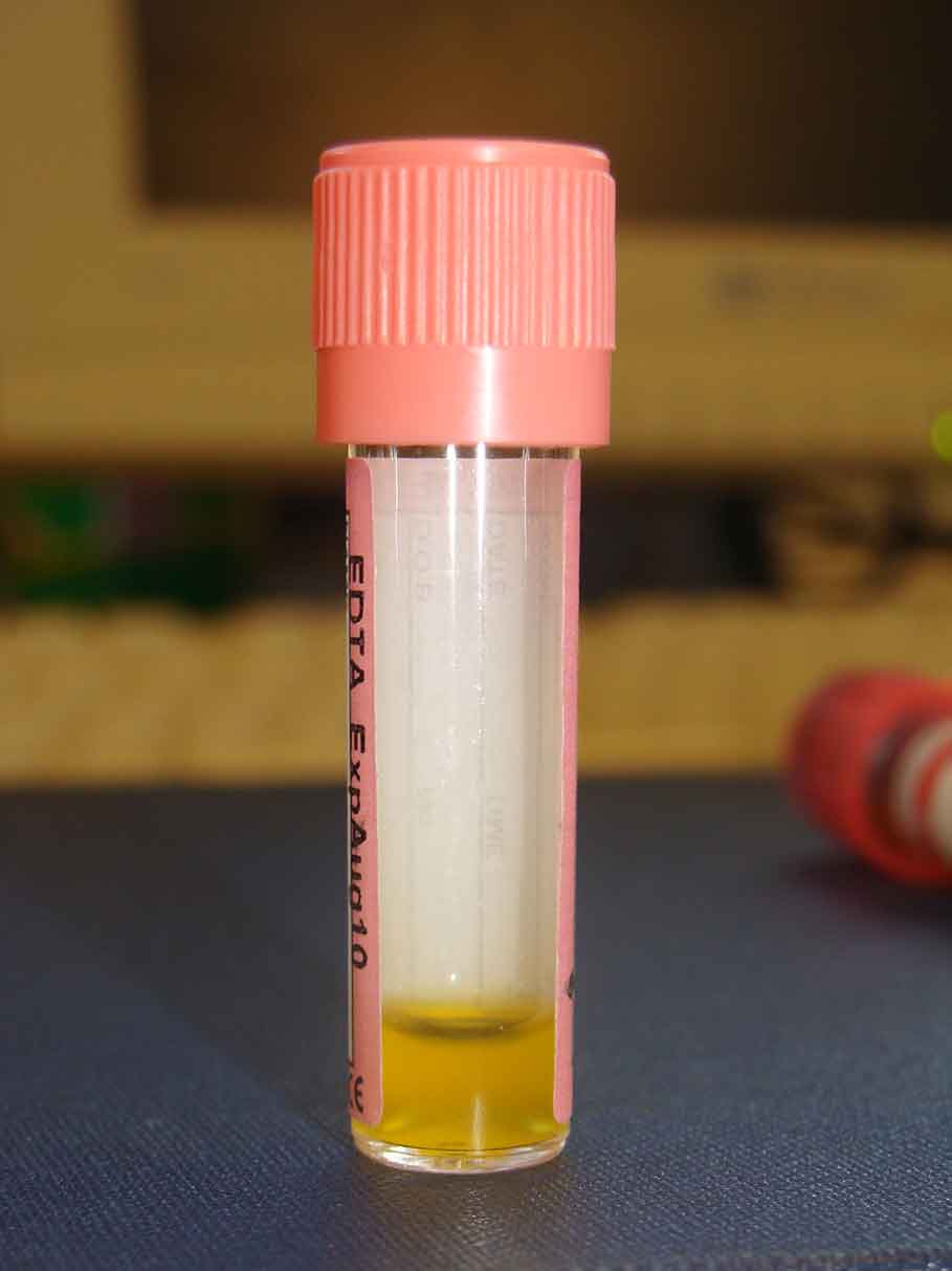 Figure 5. Effusion analysis is useful in the diagnosis of FIP; look for fluid and sample where possible.