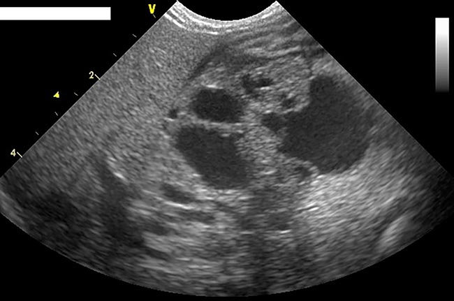 Figure 3. Typical ultrasound changes in a cat with acute pancreatitis – note the enlarged hyperechoic pancreas and surrounding hyperechoic mesenteric fat.