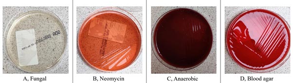 Figure 1. Routine plates used for plating transtracheal wash samples: A) fungal; B) neomycin; C) anaerobic; D) blood agar.