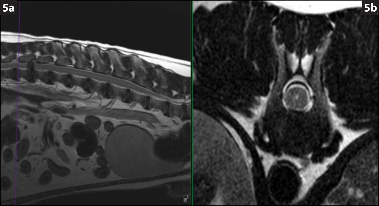 Figure 5. T2-weighted MRI of the spine in a dachshund with intervertebral disc herniation; sagittal view (5a) and transverse view at the level of a normal disc (5b).
