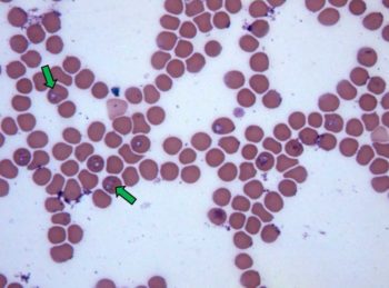 Figure 1. A blood film revealing Babesia merozoites within erythrocytes (green arrows).