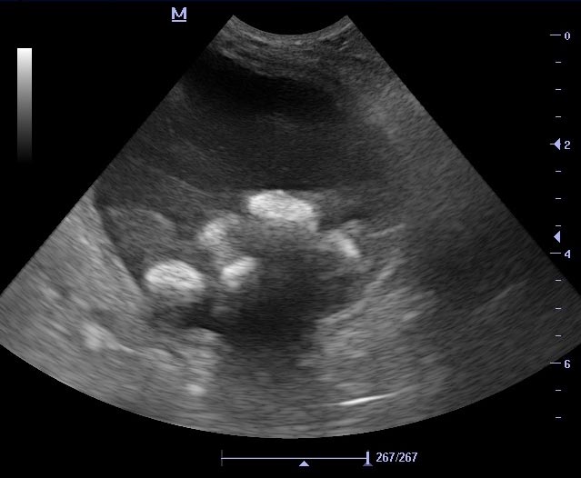 Figure 2. Ultrasound images showing typical acoustic shadowing appearance from urolith in bladder.