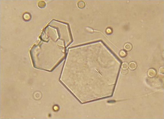 Figure 5. Microscopy of crystals (courtesy of University of Minnesota, Twin Cities).