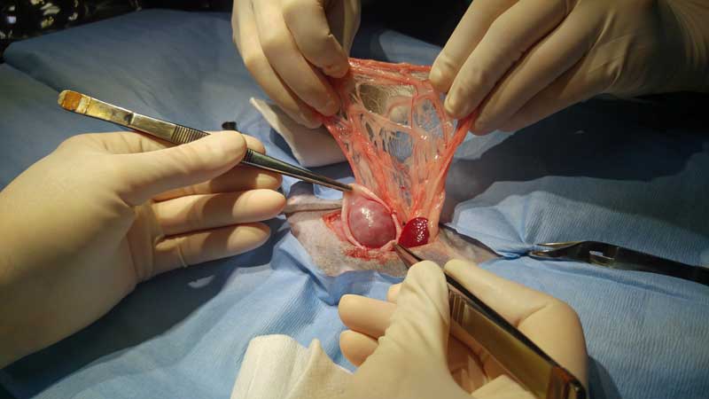The omentalised cyst.