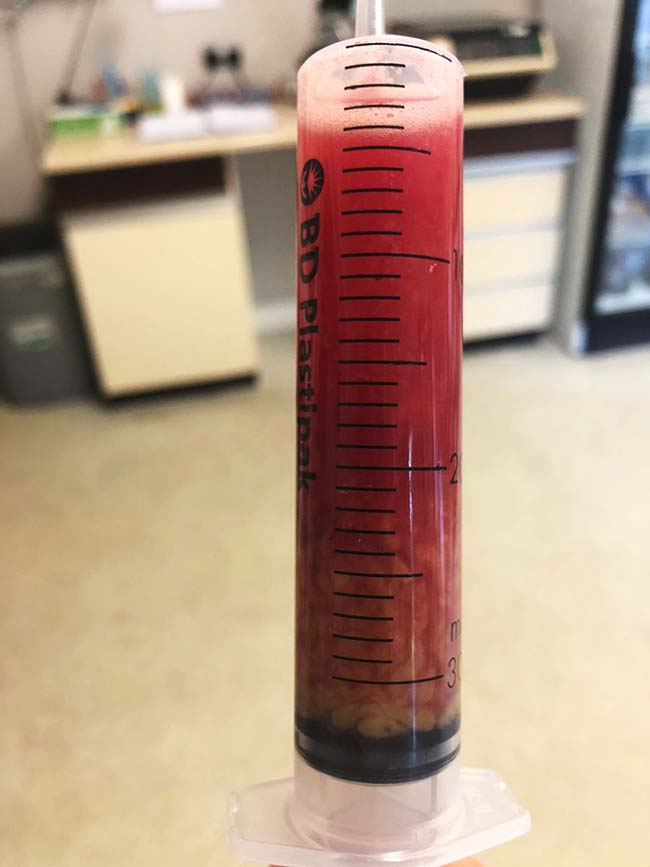 Figure 3. Percutaneous tracheal aspirate showing purulent material and blood in the sample in a horse with pleuropneumonia.